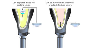 PadSil Diagram